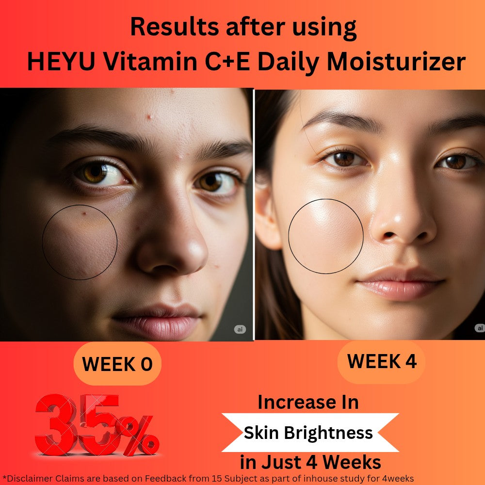 Vitamin C + E Moisturizer – 50gm